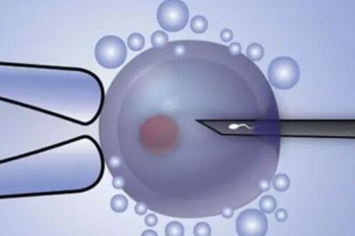 三代试管婴儿取卵数量与成功率的科学解析